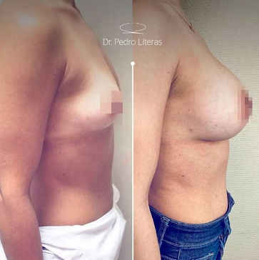 Slider image (6) Dr. Pedro Literas